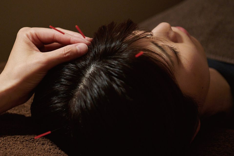 「寝ても疲れが取れない」のはなぜ？睡眠のプロ集団が手掛ける電気鍼体験レポ！
